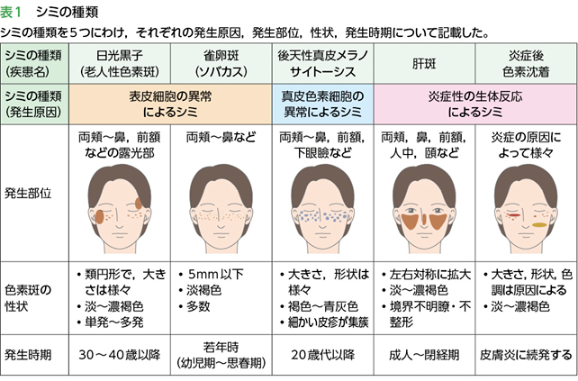 シミの5タイプ