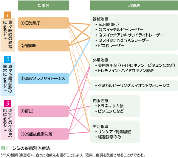 シミの疾患別治療法